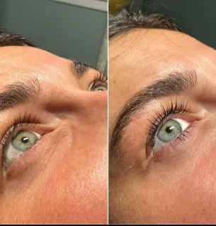 Lash treatment