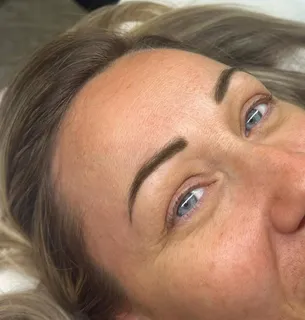 Brow treatment