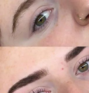 Brow treatment