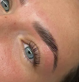 Brow treatment