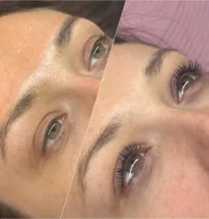 Lash treatment