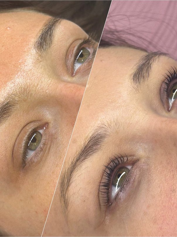 Natural lash enhancement
