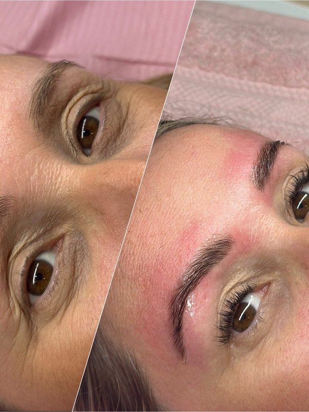 Precision brow architecture